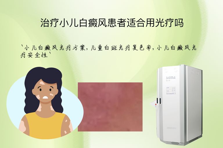 治疗小儿白癜风患者适合用光疗吗