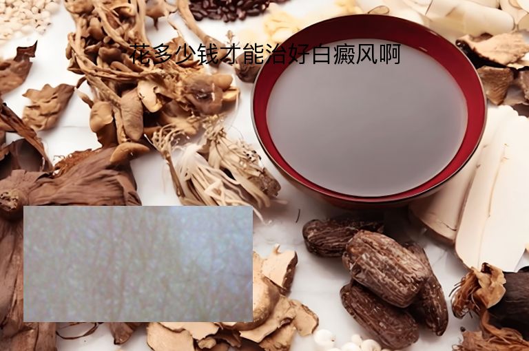 https://www.bdfsjzyy.com/d/file/p/c63a86cce3852ca77ae68e8fecb6ca09.jpeg
