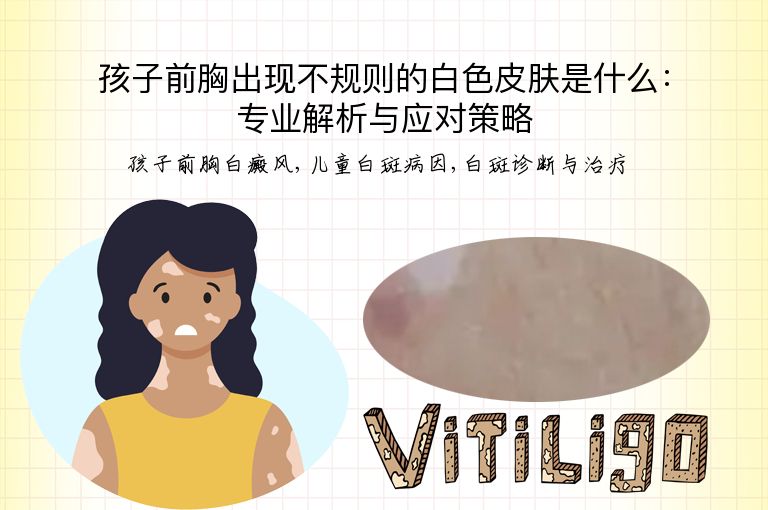 孩子前胸出现不规则的白色皮肤是什么：专业解析与应对策略”