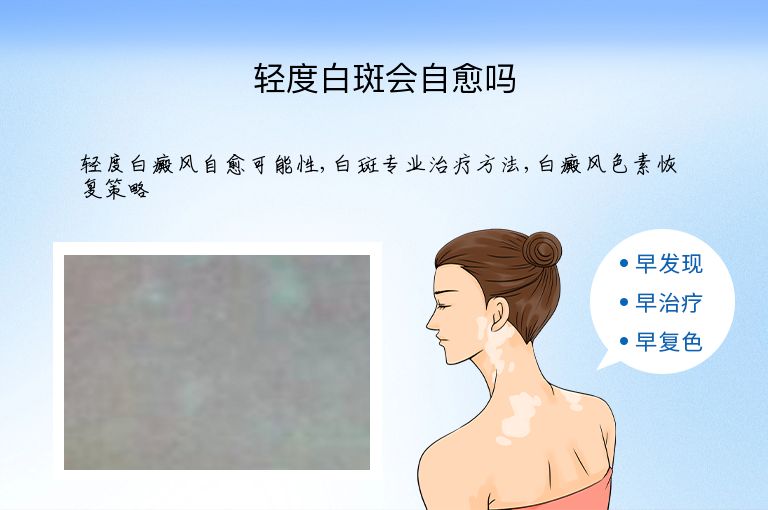 https://www.bdfsjzyy.com/d/file/p/fba2d0a18fca295bd0dc0db452b46096.jpeg