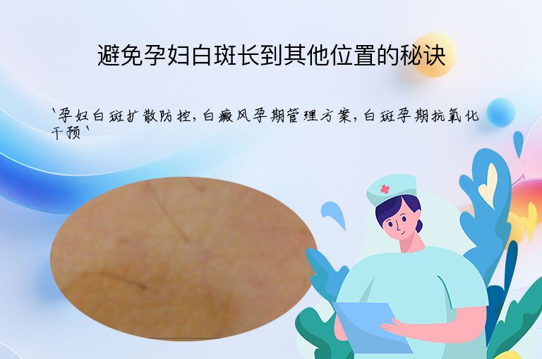 避免孕妇白斑长到其他位置的秘诀