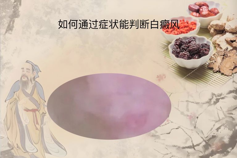 如何通过症状能判断白癜风