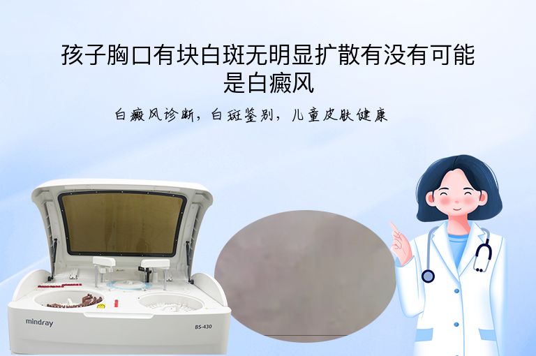 https://www.bdfsjzyy.com/d/file/p/c01e026d4fe214f2912c7ac433248774.jpeg