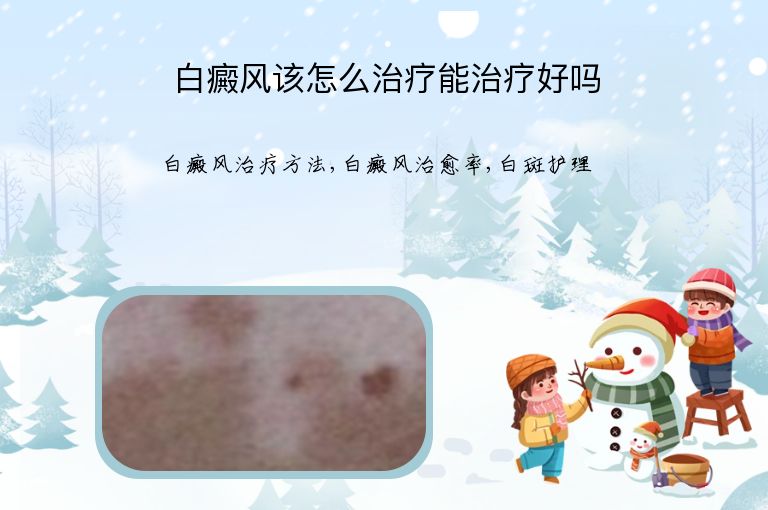 白癜风该怎么治疗能治疗好吗”