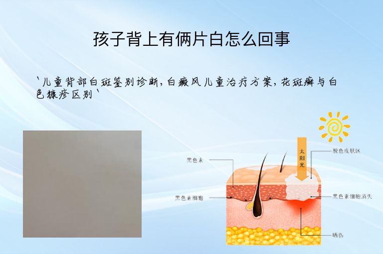 孩子背上有俩片白怎么回事