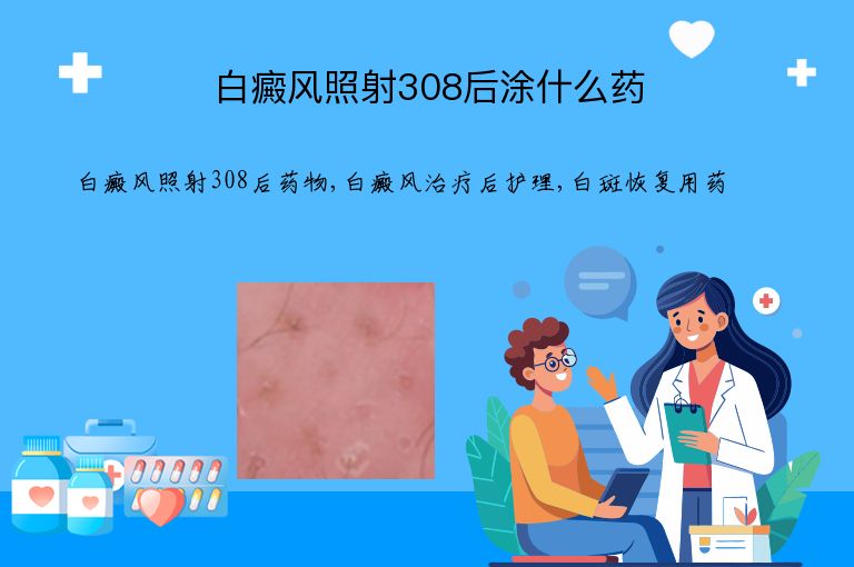 白癜风照射308后涂什么药”
