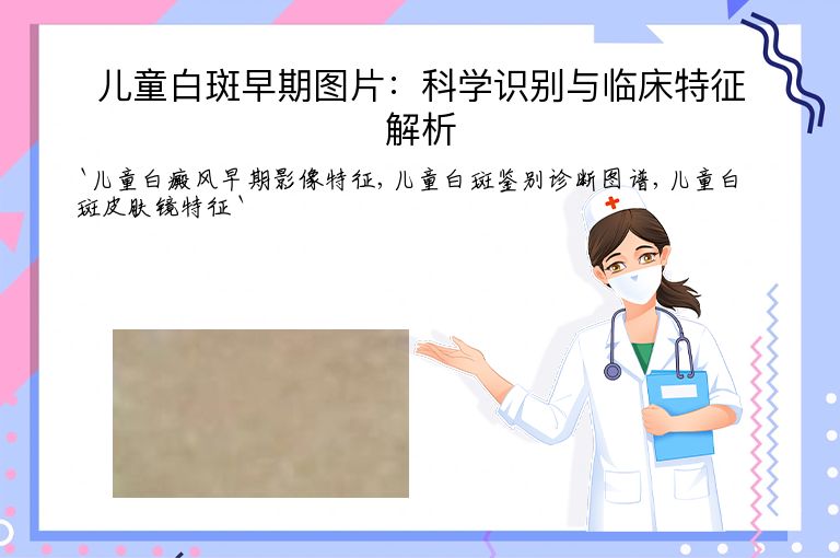 儿童白斑早期图片：科学识别与临床特征解析