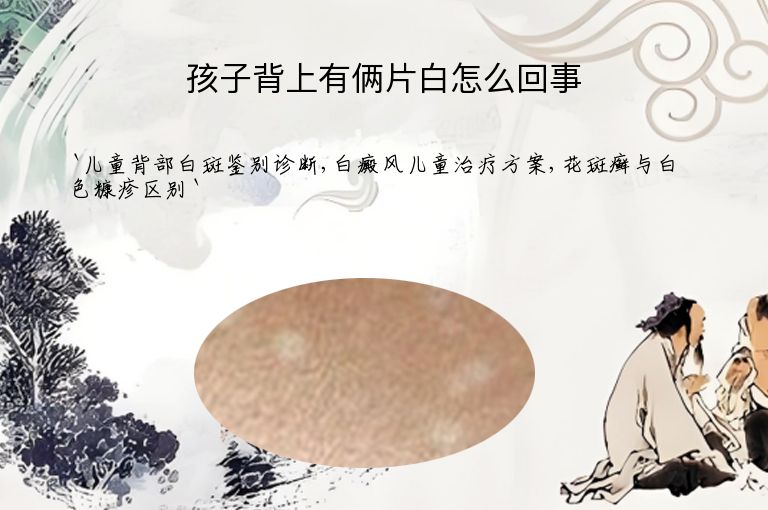 孩子背上有俩片白怎么回事