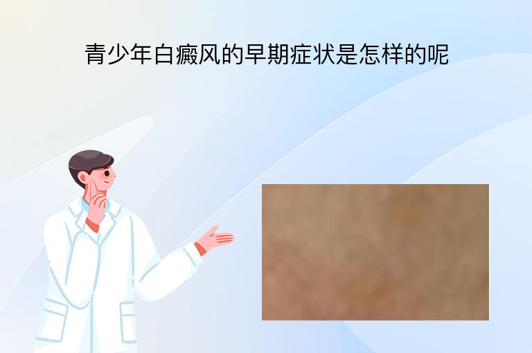 青少年白癜风的早期症状是怎样的呢