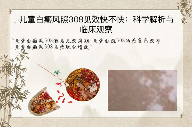 儿童白癜风照308见效快不快:科学解析与临床观察