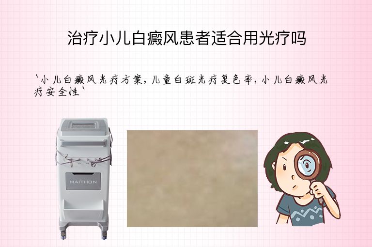 治疗小儿白癜风患者适合用光疗吗
