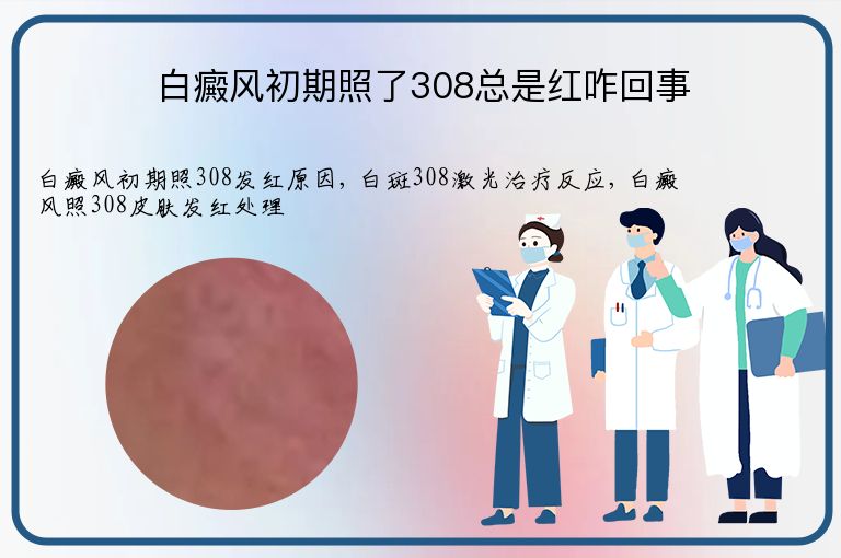 https://www.bdfsjzyy.com/d/file/p/e924b3c8c6bd3ba6e3d10a2a2618dcf3.jpeg