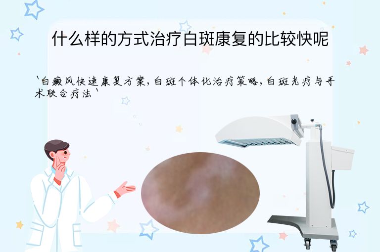 什么样的方式治疗白斑康复的比较快呢