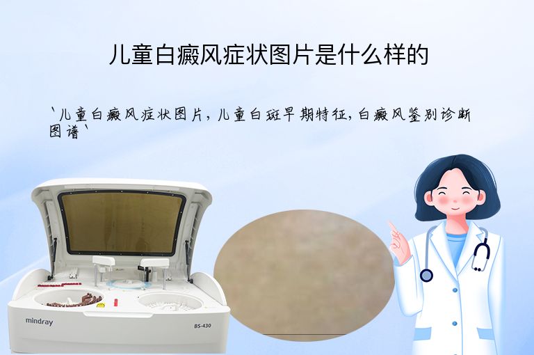 https://www.bdfsjzyy.com/d/file/p/a2ce1d84fd9bdc750bb1fb219205e2b6.jpeg