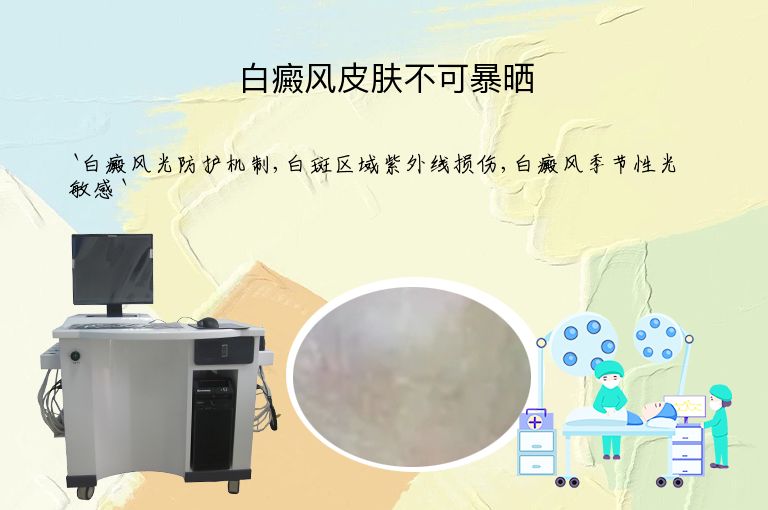 白癜风皮肤不可暴晒