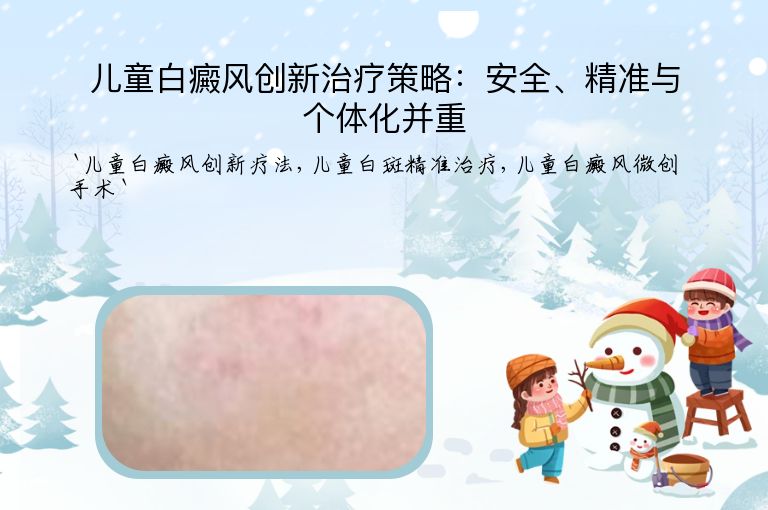 儿童白癜风创新治疗策略:安全、精准与个体化并重