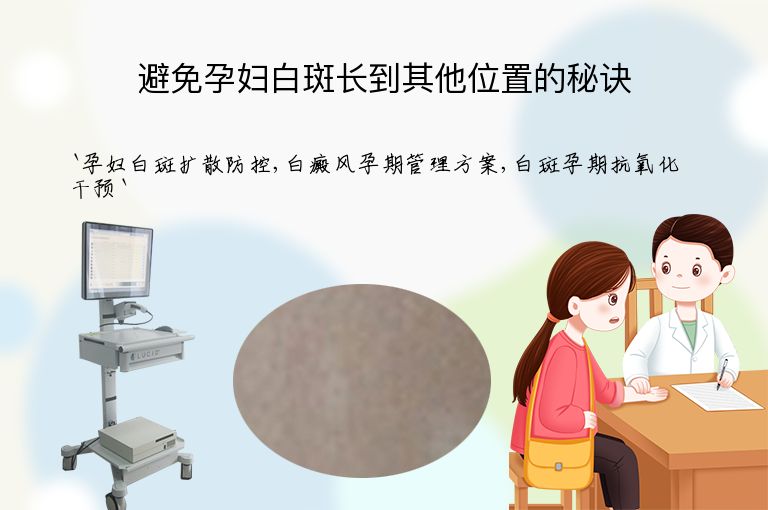 避免孕妇白斑长到其他位置的秘诀