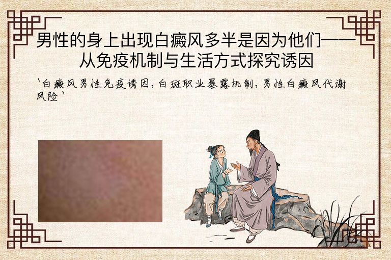 男性的身上出现白癜风多半是因为他们——从免疫机制与生活方式探究诱因