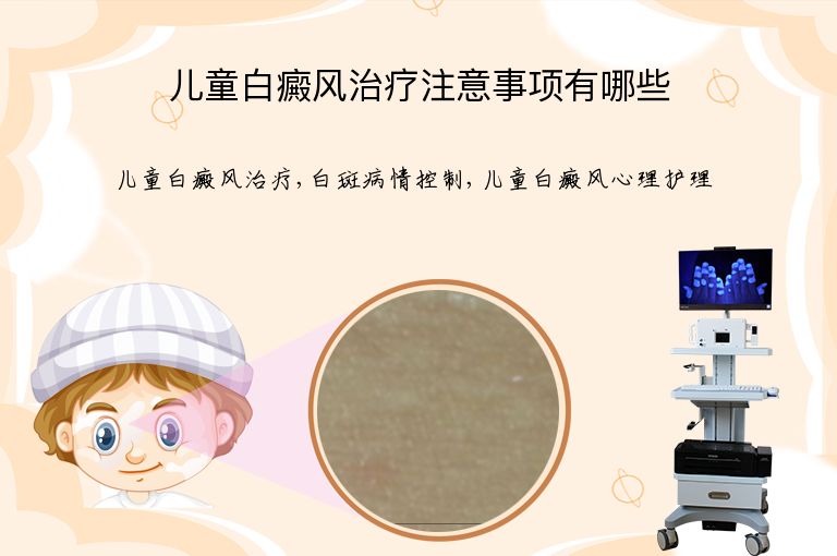 https://www.bdfsjzyy.com/d/file/p/4ec868d09e240f016298aaafc91fd21e.jpeg