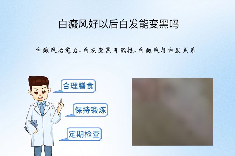 白癜风好以后白发能变黑吗”