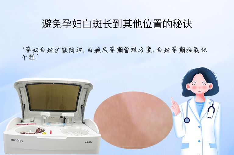 避免孕妇白斑长到其他位置的秘诀
