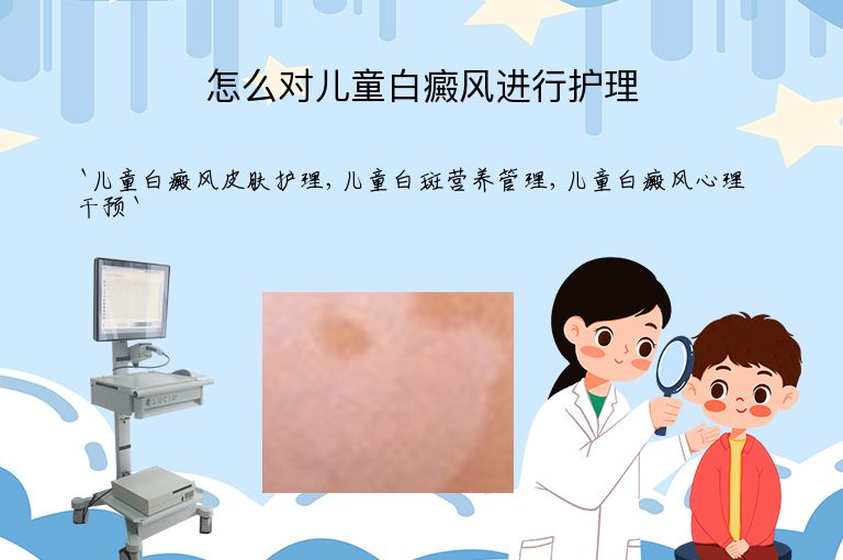怎么对儿童白癜风进行护理”