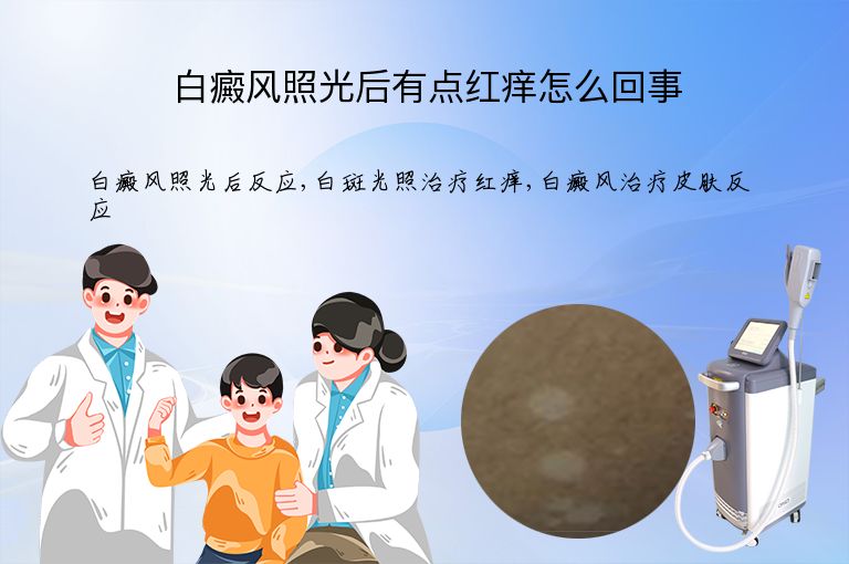 白癜风照光后有点红痒怎么回事”