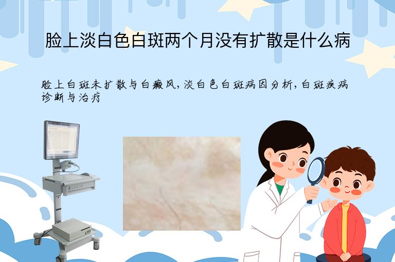 脸上淡白色白斑两个月没有扩散是什么病”