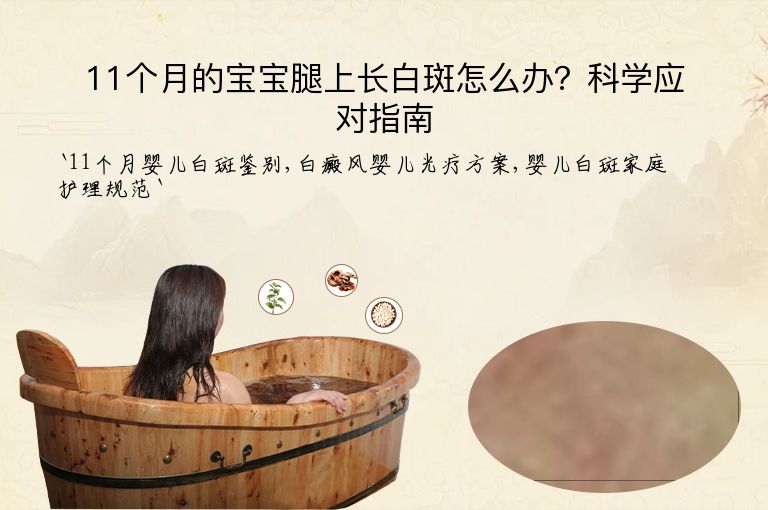 11个月的宝宝腿上长白斑怎么办？科学应对指南”