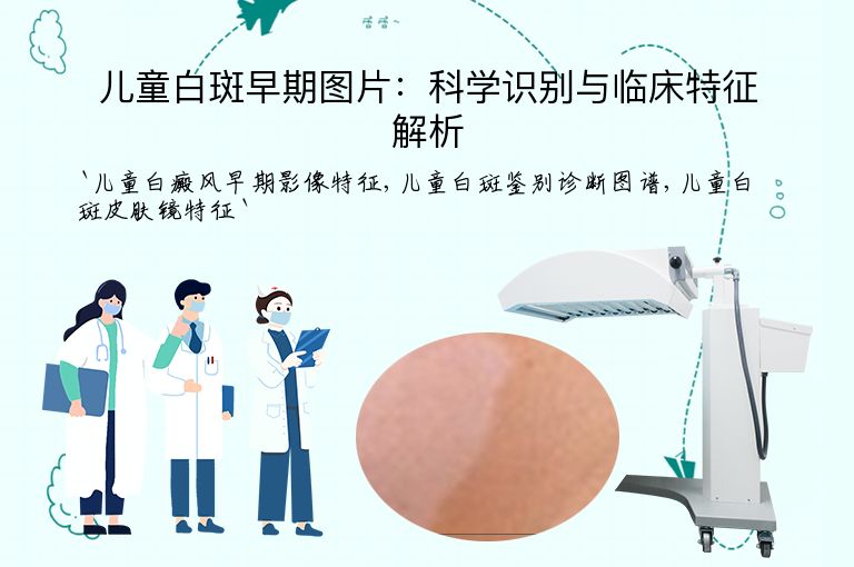 儿童白斑早期图片:科学识别与临床特征解析