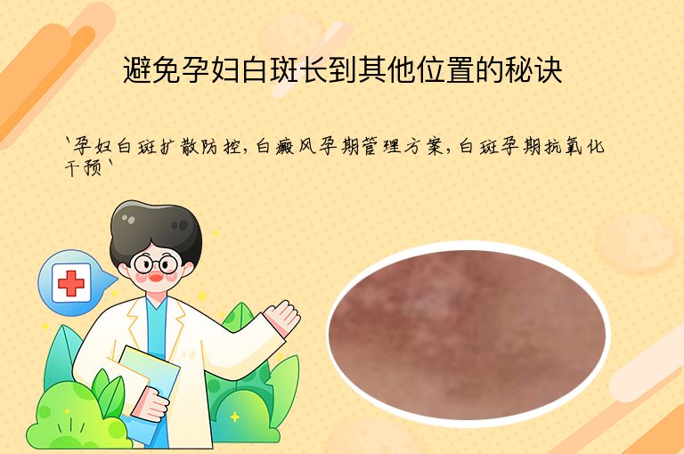 避免孕妇白斑长到其他位置的秘诀
