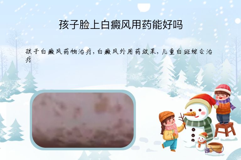 孩子脸上白癜风用药能好吗”