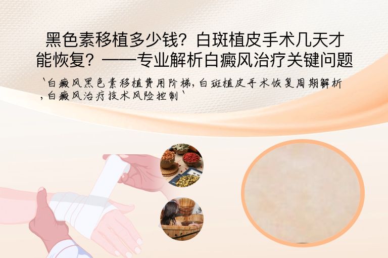 黑色素移植多少钱?白斑植皮手术几天才能恢复?——专业解析白癜风治疗关键问题”