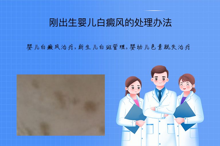 刚出生婴儿白癜风的处理办法”
