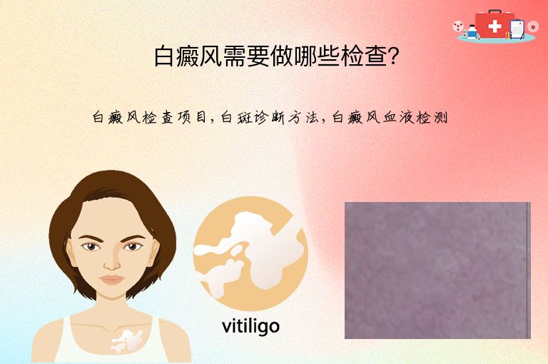 白癜风需要做哪些检查?”