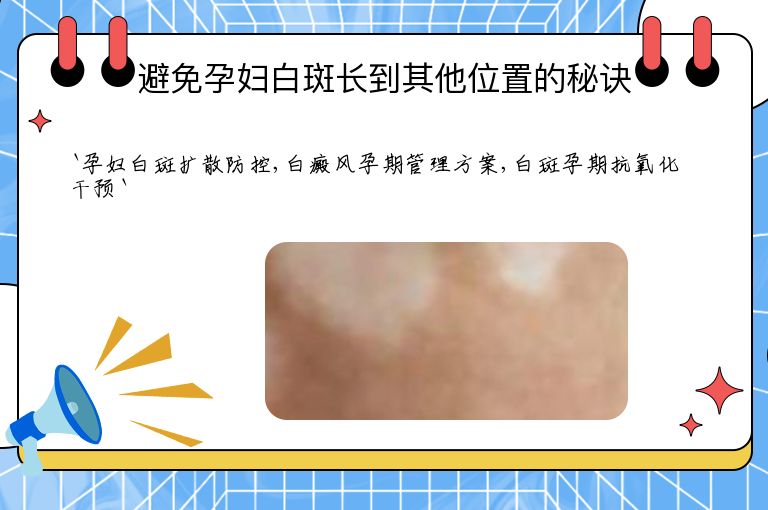 避免孕妇白斑长到其他位置的秘诀