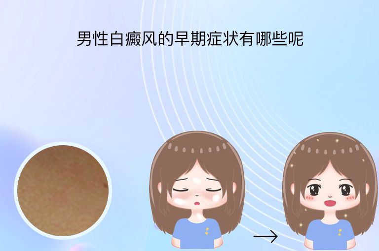 男性白癜风的早期症状有哪些呢