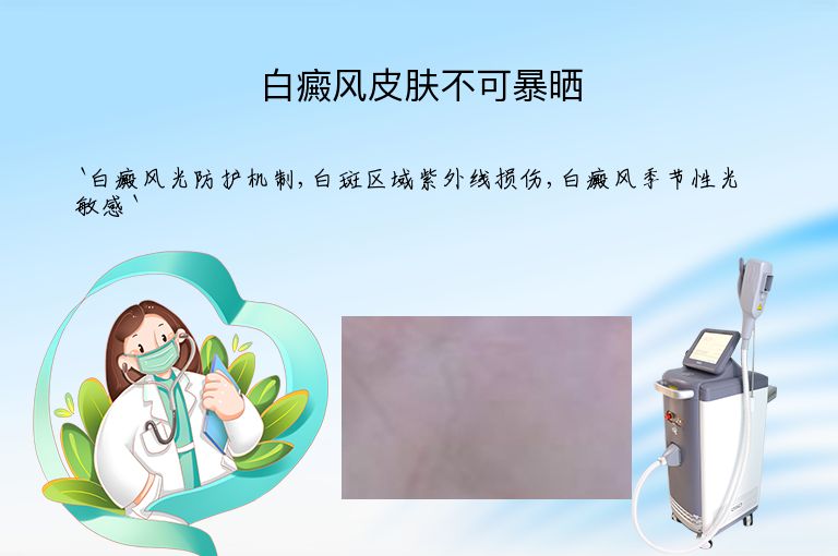 白癜风皮肤不可暴晒