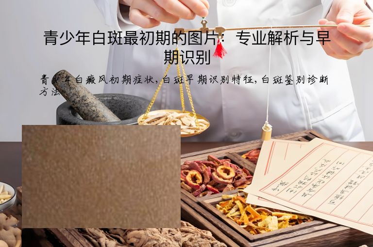 青少年白斑最初期的图片:专业解析与早期识别”