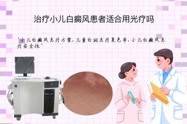 治疗小儿白癜风患者适合用光疗吗
