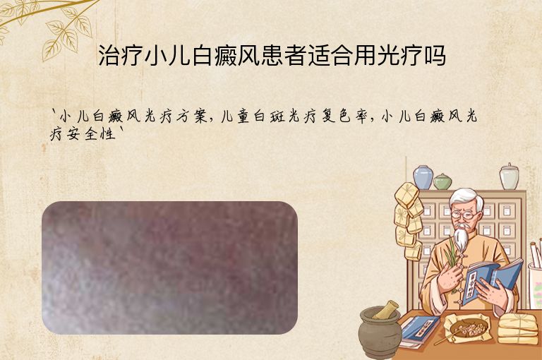 治疗小儿白癜风患者适合用光疗吗
