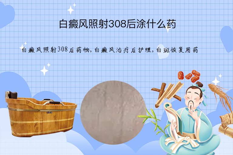 白癜风照射308后涂什么药”