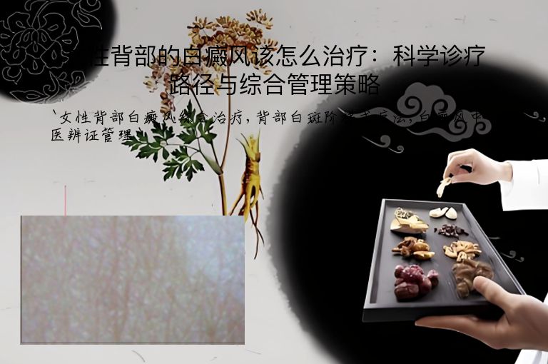 女性背部的白癜风该怎么治疗：科学诊疗路径与综合管理策略