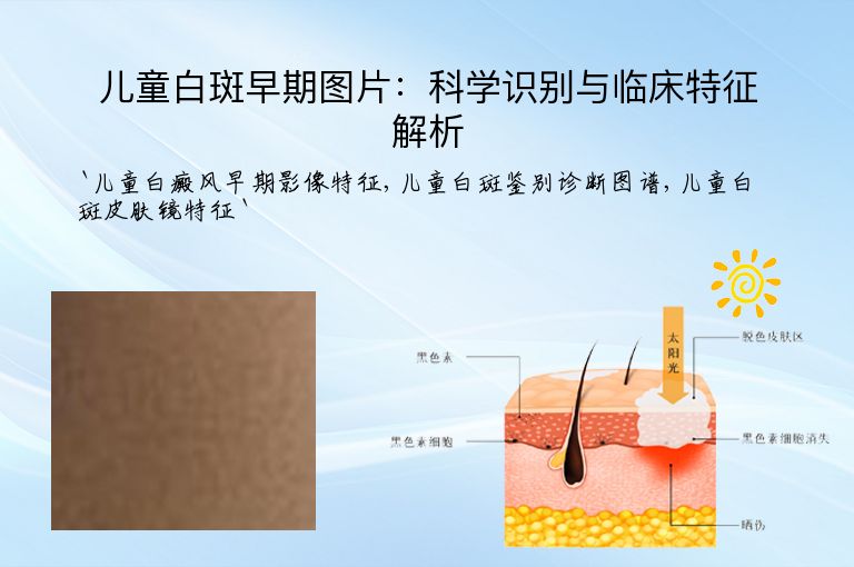 儿童白斑早期图片:科学识别与临床特征解析