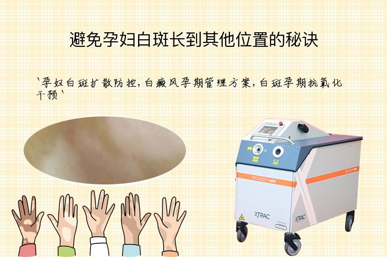 避免孕妇白斑长到其他位置的秘诀