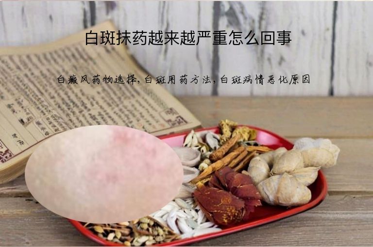 https://www.bdfsjzyy.com/d/file/p/7c4708838aa986da5d2bb194db46fd75.jpeg