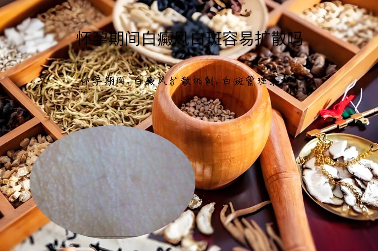 怀孕期间白癜风白斑容易扩散吗”