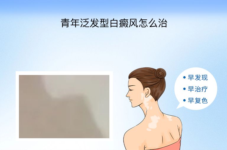 https://www.bdfsjzyy.com/d/file/p/8e1d7a52c3db5cec56f1a4f3c2702a1c.jpeg
