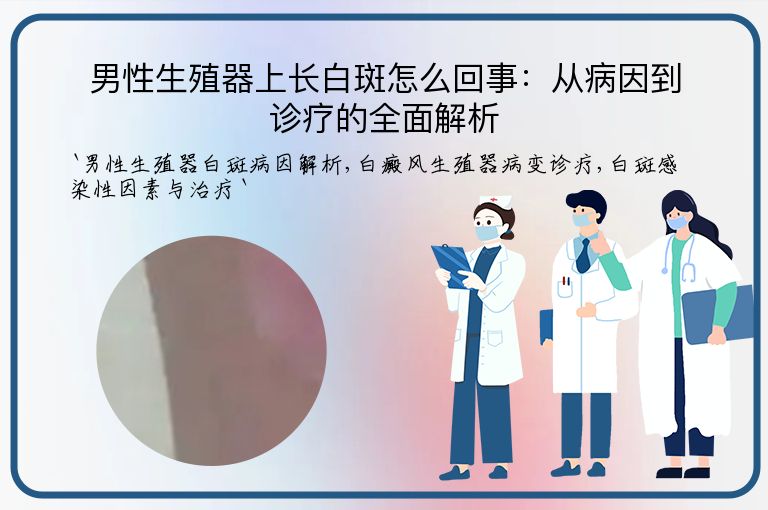 男性生殖器上长白斑怎么回事:从病因到诊疗的全面解析