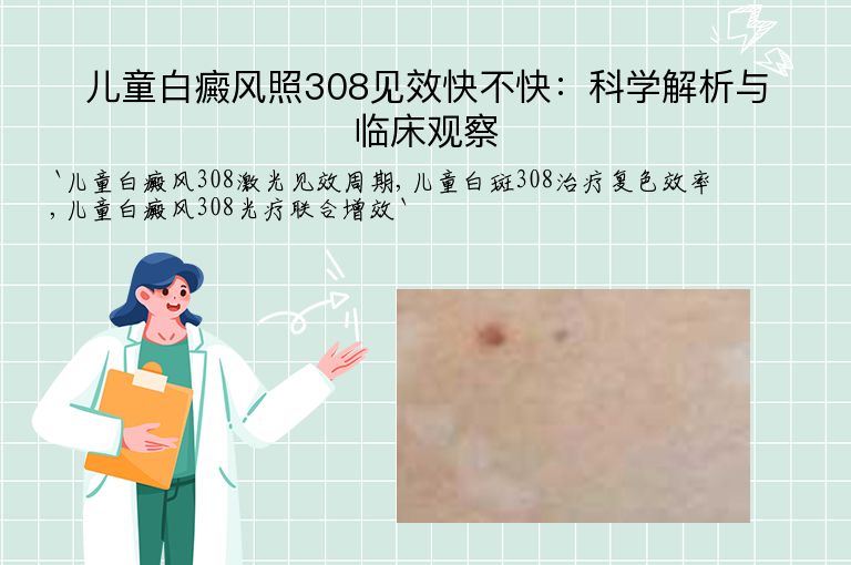 儿童白癜风照308见效快不快：科学解析与临床观察